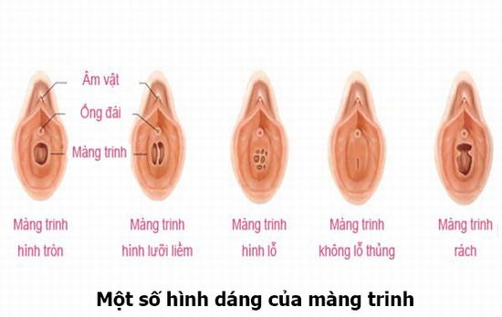 màng trinh là gì