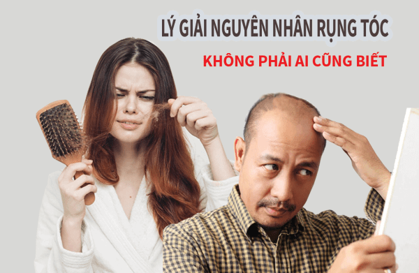 thay đổi nội tiết tố ở nam và nữ là nguyên nhân gây rụng tóc