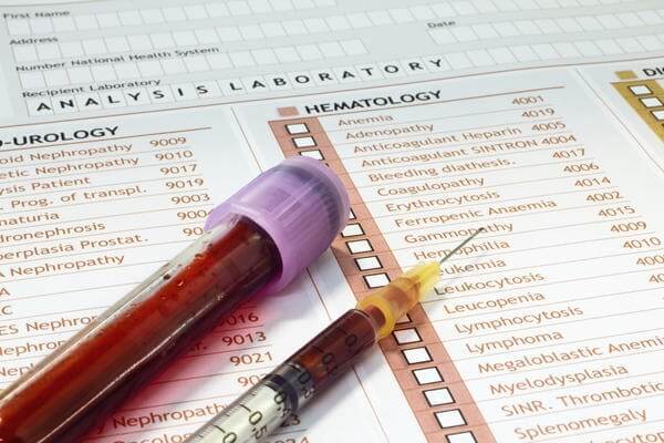 Trước khi tiêm phòng viêm gan B cần xét nghiệm HBsAg và antiHBs