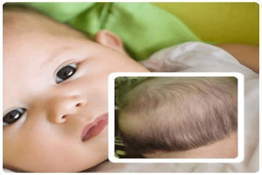 tại sao trẻ 3 tháng tuổi bị rụng tóc